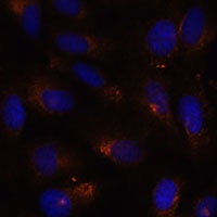 ESYT1 antibody