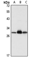 ETFB Antibody