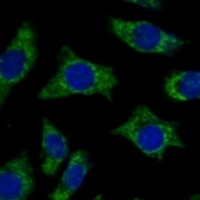 ETFB Antibody