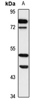 Ethanolamine Kinase 1 Rabbit Polyclonal Antibody