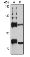 SEC3 Rabbit Polyclonal Antibody