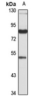 SEC6 Rabbit Polyclonal Antibody