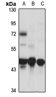 Factor VII Antibody