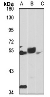 FADS1 Rabbit Polyclonal Antibody