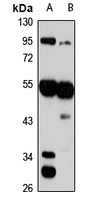 FADS3 Rabbit Polyclonal Antibody