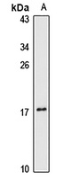 FAM127B Rabbit Polyclonal Antibody