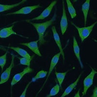 FAM127B Rabbit Polyclonal Antibody