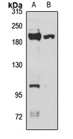 FAM208A Rabbit Polyclonal Antibody