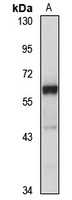 FAM98A Rabbit Polyclonal Antibody