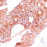 Anti-FAM98A Antibody