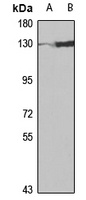 FBXO11 Rabbit Polyclonal Antibody