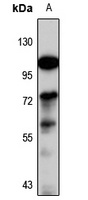 FBXO24 Rabbit Polyclonal Antibody