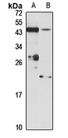 FBXO25 Rabbit Polyclonal Antibody
