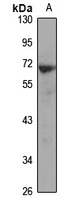 Fc epsilon RI alpha Rabbit Polyclonal Antibody