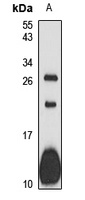 Fc epsilon RI gamma Rabbit Polyclonal Antibody