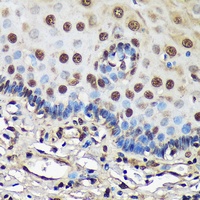 Anti-FCF1 Antibody