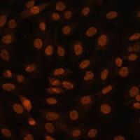 Anti-FCF1 Antibody