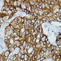 FCGR1B antibody
