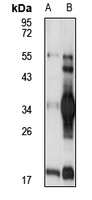 Ficolin 3 Antibody