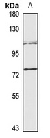 FEM1B Rabbit Polyclonal Antibody
