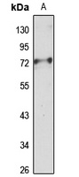 FEZ1 Rabbit Polyclonal Antibody