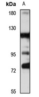 FGD1 Rabbit Polyclonal Antibody