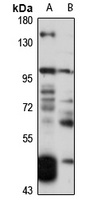 DOC1 Rabbit Polyclonal Antibody