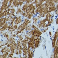 Anti-FKBP1B Antibody