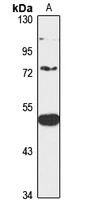 Folliculin Rabbit Polyclonal Antibody