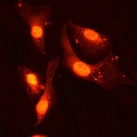 Folliculin Rabbit Polyclonal Antibody
