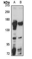 Flightless-1 Rabbit Polyclonal Antibody