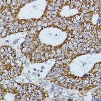 Anti-Flightless-1 Antibody
