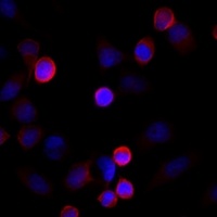 FLNC Antibody