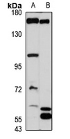 FMNL1 Antibody