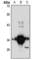 FN3K Antibody