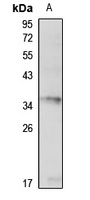FOXB1 Rabbit Polyclonal Antibody