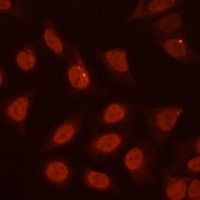 Anti-BF-1 Antibody