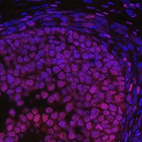 FOXL2 antibody