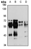 FOXRED1 Antibody