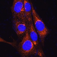Anti-FREM2 Antibody