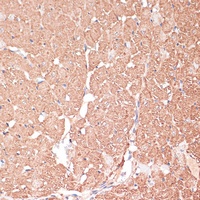Anti-FRMD6 Antibody