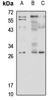 G6B Rabbit Polyclonal Antibody