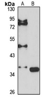 G6Pase-beta Rabbit Polyclonal Antibody