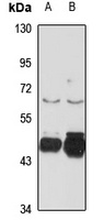 GABRB3 Rabbit Polyclonal Antibody
