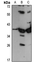 GALM Antibody