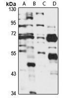 GalNAc-T10 Rabbit Polyclonal Antibody