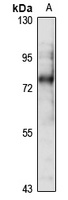 GalNAc-T6 Rabbit Polyclonal Antibody