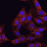 Alpha-glucosidase 2 antibody
