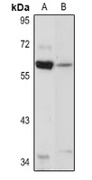 GATA6 Rabbit Polyclonal Antibody