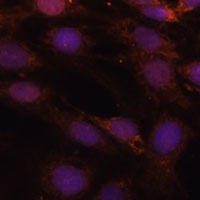 Anti-GCAT Antibody